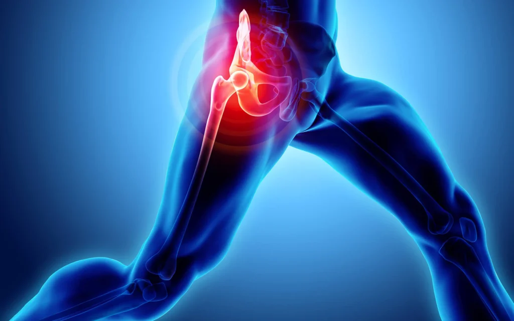 knee replacement surgery cost in lucknow