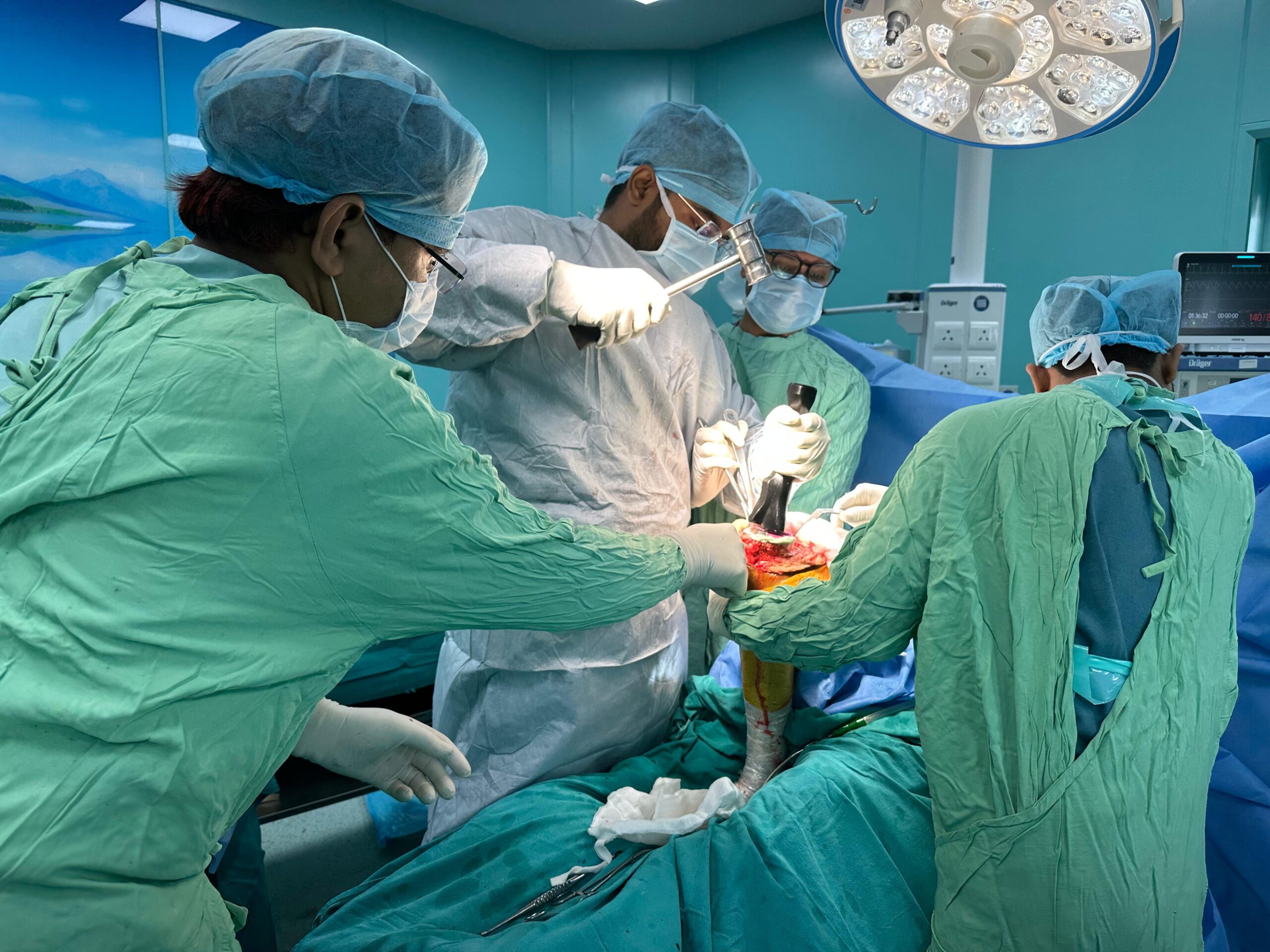 bone and joint doctor Lucknow scaled -